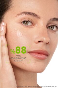 Bioderma Sebium Serum 30 ml SKT:02/2026